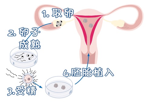 胚胎培养室
